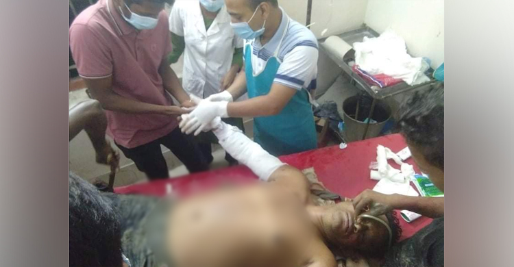 শ্রমিক লীগ নেতার হাত কেটে বিচ্ছিন্ন করে দিল সন্ত্রাসীরা