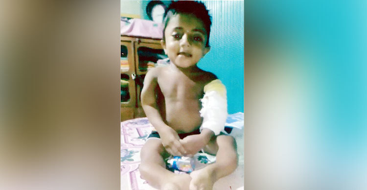 বিরল রোগ লিখনের, ১০ বছরেই হাড় ভেঙেছে ৩২ বার