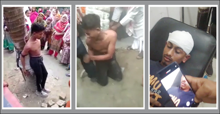 ফোনে ডেকে নিয়ে যুবকের দুই পা ভেঙে দিলেন প্রেমিকার চাচা