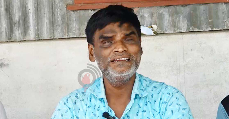 বাঁচতে চান মানিকগঞ্জের অন্ধ গায়ক নরেশ দাস, প্রয়োজন অর্থ সাহায্য