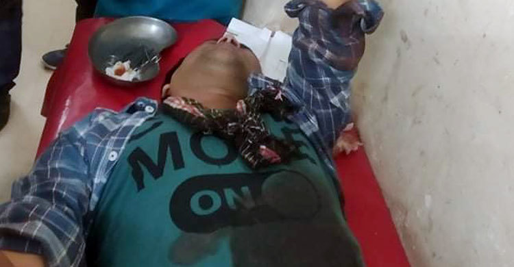 এমপির পিএ’র নেতৃত্বে ঘের দখল, হামলায় ঘের মালিকসহ আহত ৩