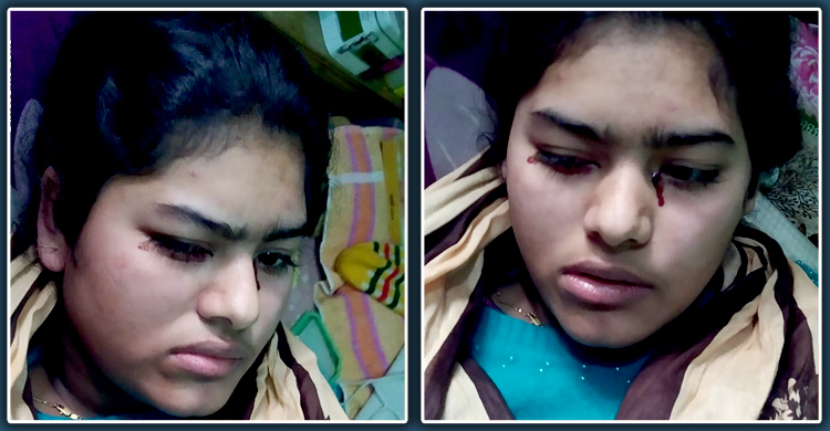 চোখ দিয়ে জল নয়, রক্ত ঝরে মুক্তার