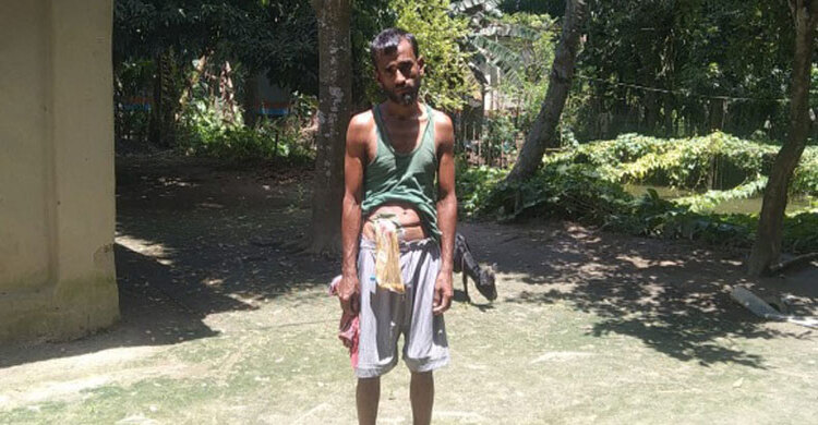 চিকিৎসকের ভুল অস্ত্রোপচারের মাশুল গুনছেন মোশাররফ