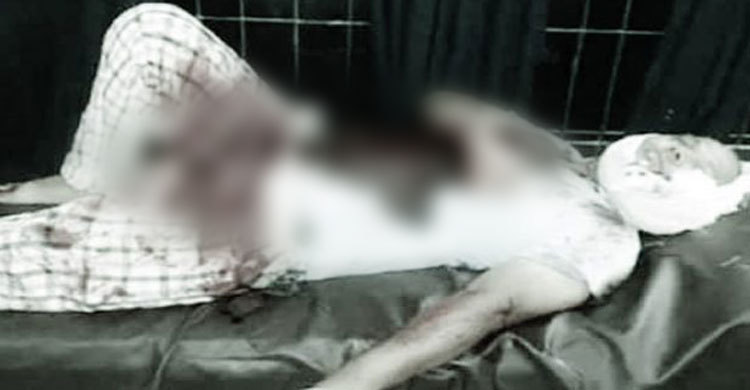 নাটোরে ব্যবসায়ীকে কোপাল দুর্বৃত্তরা