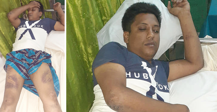 পুলিশ হেফাজতে যুবকের চোখ বেঁধে নির্যাতনের অভিযোগ