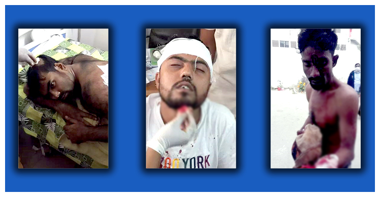 সিদ্ধিরগঞ্জে আওয়ামী লীগের দু’গ্রুপের সংঘর্ষে আহত ১৫