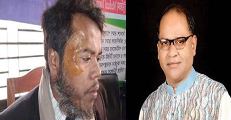 নাটোরে আইনজীবীকে হত্যাচেষ্টায় আ.লীগ নেতা বিরুদ্ধে মামলা