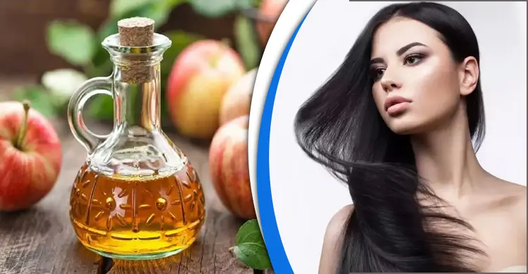 চুলে আপেল সাইডার ভিনেগার ব্যবহার করলে কী হয়?