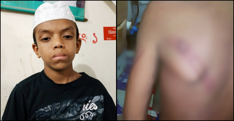 ঘুম থেকে ডেকে তুলে শিক্ষার্থীকে নির্যাতন, মাদরাসাশিক্ষক কারাগারে