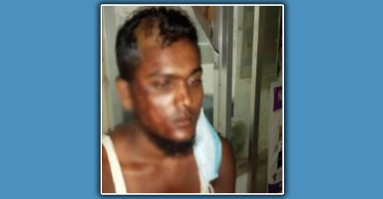 জামিনে বেরিয়ে মামলার বাদীকে কুপিয়ে জখম