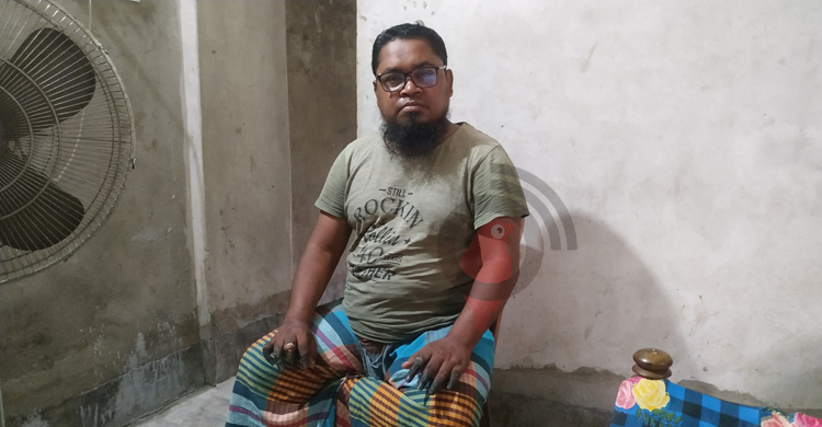 আঙুলের পর এবার ‘পাথর’ হয়ে যাচ্ছে নুরুল আমিনের চোখ