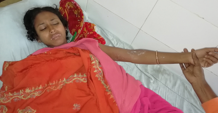 স্ত্রীর চোখ নষ্ট করার পর এবার শরীর ঝলসে দিল স্বামী