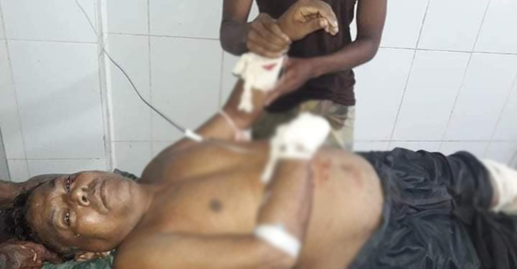 চাচার হাতের কব্জি কেটে নিয়ে পুকুরে ফেলল ভাতিজা