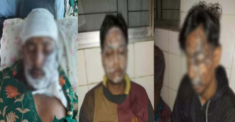 পাওনা টাকা চাওয়ায় অ্যাসিড নিক্ষেপ, একই পরিবারে দগ্ধ ৩