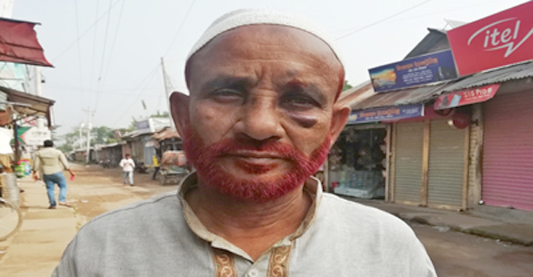 যুদ্ধাপরাধ মামলার বাদী হওয়ায় মুক্তিযোদ্ধাকে মারধর