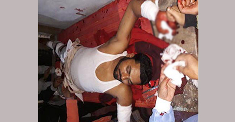 যুবলীগ নেতাকে কুপিয়ে জখম