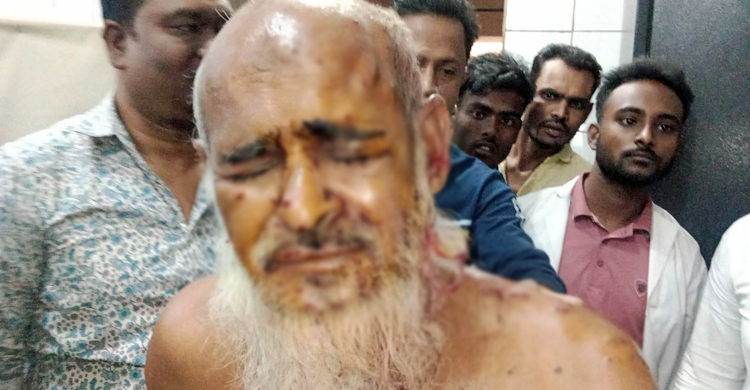 রাজবাড়ীতে ফের বাল্কহেডে হামলা, গুলিবিদ্ধ ১