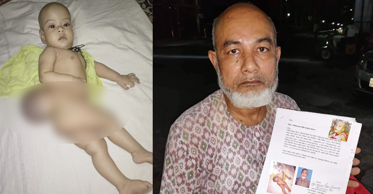 দুই দফায় ফেটেছে টিউমার, অভাবে মেয়েকে ঢাকায় আনতে পারছেন না বাবা
