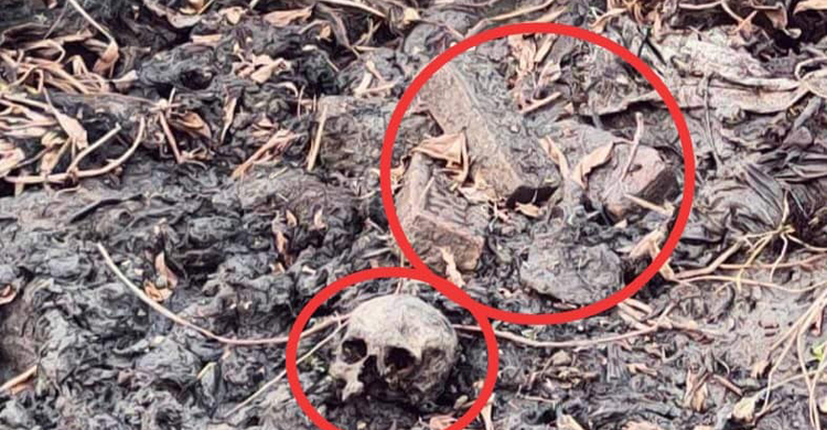 ডোবায় বস্তাবন্দি মাথার খুলি-হাড় উদ্ধার