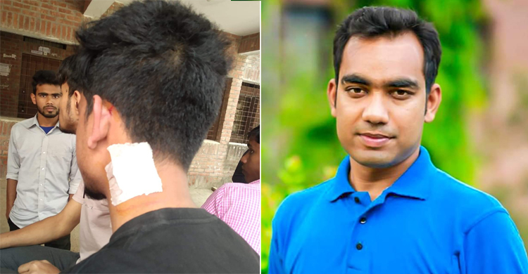 ফ্যানের সুইচ বন্ধ করতে বলায় শিক্ষার্থীকে মারধর ছাত্রলীগ নেতার