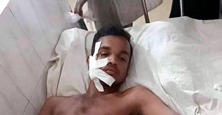 ইভটিজিংয়ের প্রতিবাদ করায় ছাত্রলীগ নেতা‌কে কু‌পি‌য়ে জখম