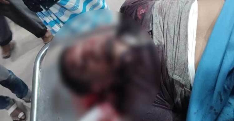 রূপগঞ্জে আধিপত্য বিস্তারকে কেন্দ্র করে সংঘর্ষ, নিহত ১