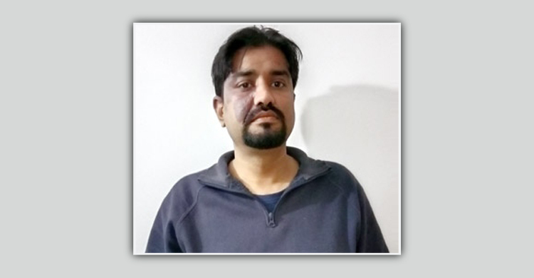 সাবেক স্ত্রীর দেওয়া গরম পানিতে ঝলসে গেলো বিশেষ অঙ্গ