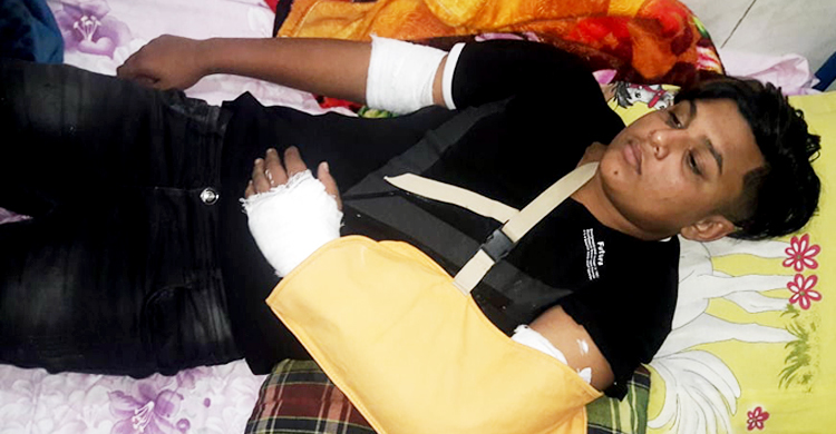 ছাত্রলীগ নেতার হাতুড়িপেটায় হাত ভাঙল কলেজছাত্রের