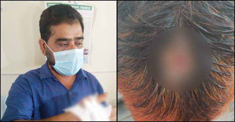 স্বাস্থ্য কমপ্লেক্সের ছাদের পলেস্তারা খসে দুই কর্মচারী আহত