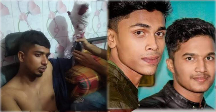 ২০ টাকা নিয়ে বিরোধ, যুবলীগ নেতার হাতের আঙুল কাটল ছাত্রলীগ নেতারা