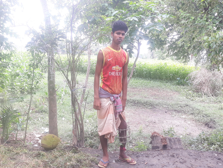 টাকার অভাবে ভাঙা পা থেকে রড বের করতে পারছেন না ইউসুফ