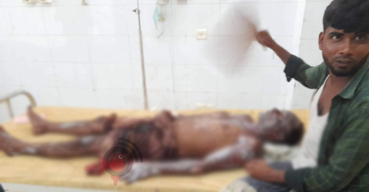 ভ্রাম্যমাণ আদালতের অভিযানে জাল পোড়ানোর সময় দগ্ধ ৩