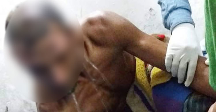 সাতক্ষীরায় কৃষকের গায়ে পেট্রল ঢেলে আগুন দিল দুর্বৃত্তরা