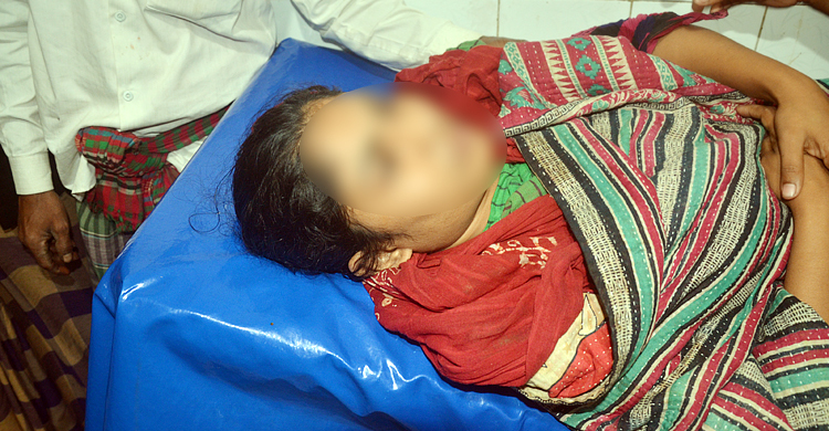 মামলার জেরে কেরোসিন ঢেলে সাবেক স্ত্রীকে হত্যাচেষ্টা