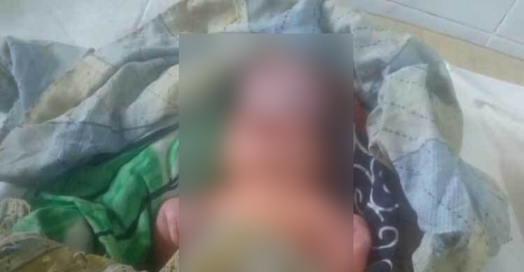 বরিশালে বিরল রোগ নিয়ে শিশুর জন্ম, দুশ্চিন্তায় পরিবার