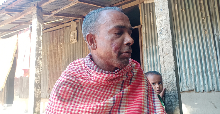 হাতির আক্রমণ থেকে বেঁচে ফেরা কৃষক নূর এখনো আঁতকে ওঠেন