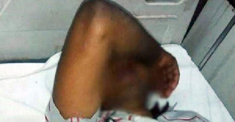 সন্তানের মুখ দেখাতে ডেকে সাবেক স্বামীর বিশেষ অঙ্গ কেটে দিল স্ত্রী