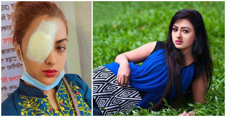 কন্টাক্ট লেন্স গলে ক্ষতিগ্রস্ত নায়িকার চোখ