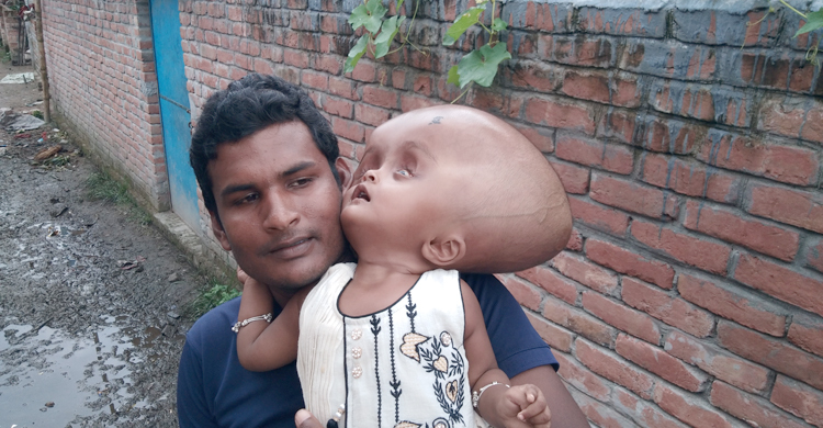 টাকার অভাবে থেমে আছে তাশমিমার চিকিৎসা