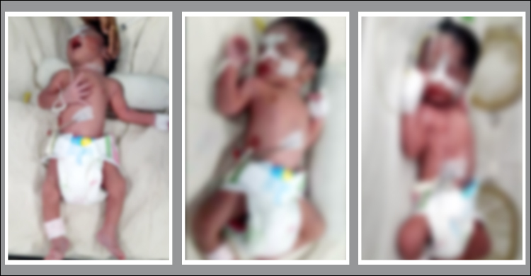 একসঙ্গে ৩ পুত্রসন্তান এলো আনসার সদস্যের ঘরে