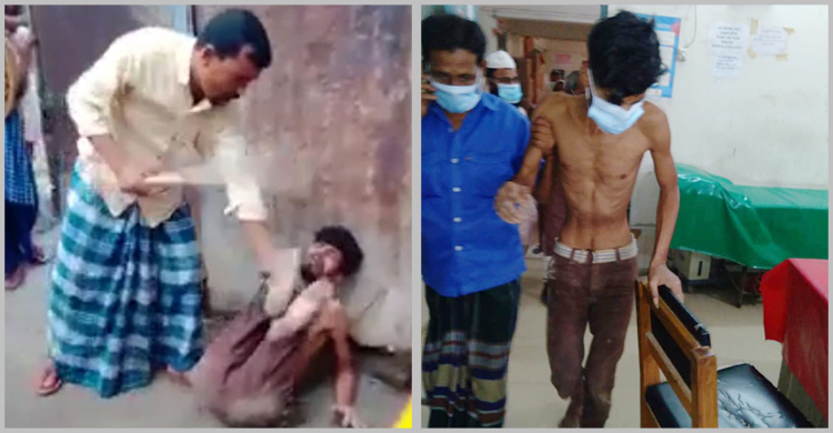 বগুড়ায় চোর সন্দেহে পায়ে পেরেক ঢুকিয়ে যুবককে নির্যাতন