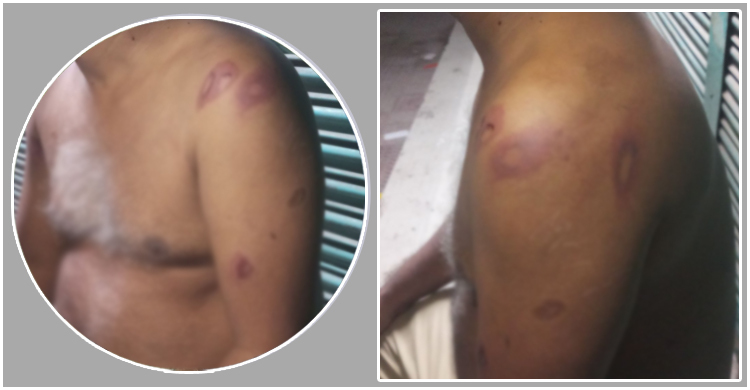 স্ত্রী-স্বজনদের নির্যাতনে পালিয়ে হাসপাতালে কলেজ শিক্ষক