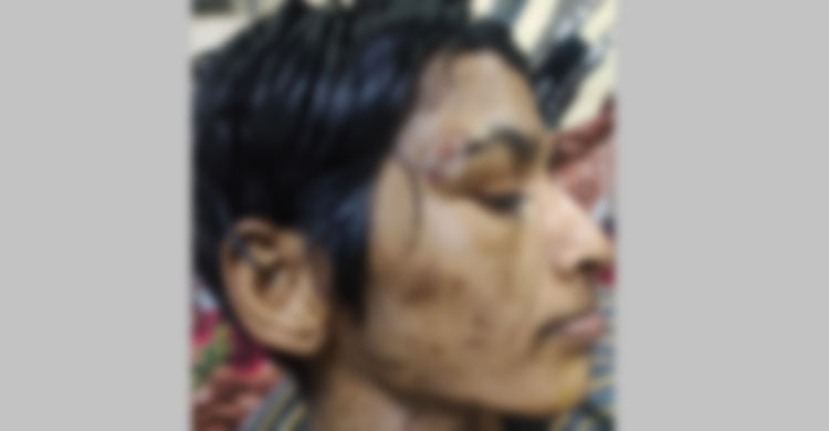 রাজধানীতে মধ্যযুগীয় কায়দায় গৃহকর্মী নির্যাতনের অভিযোগ