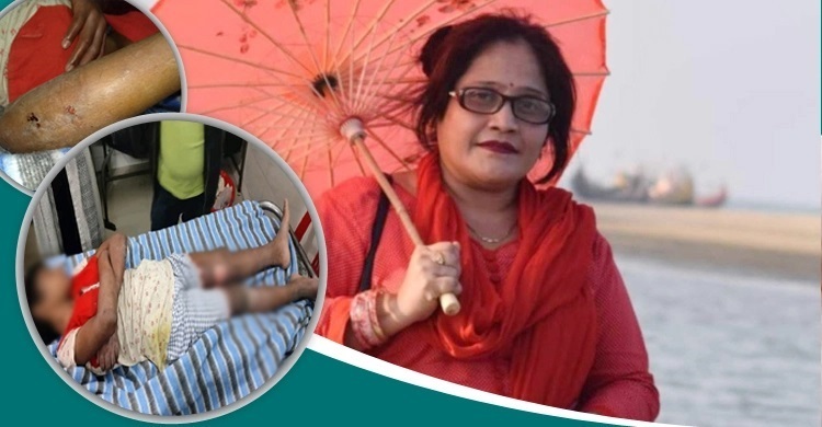 গৃহকর্মীকে গরম পানিতে ঝলসে দেওয়ার ঘটনায় গৃহকর্ত্রী কারাগারে
