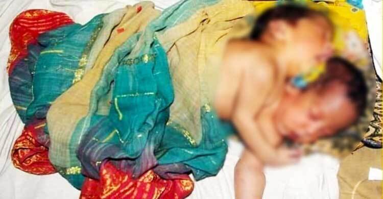 বাঁচলো না দুই মাথা নিয়ে জন্মানো সেই শিশু