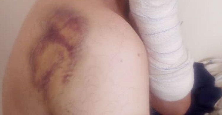 UK embassy staff allege Taliban beatings and torture in Afghanistan