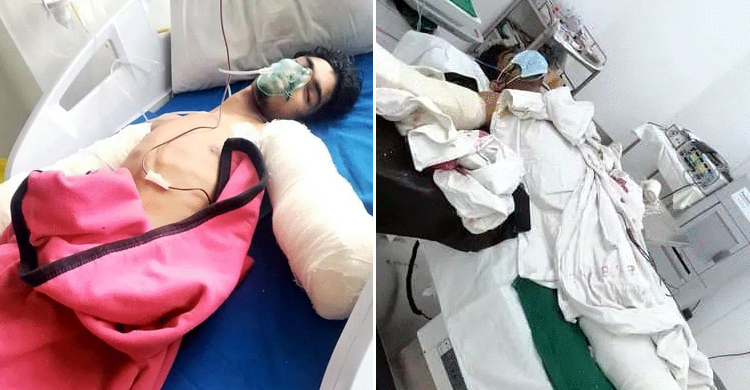 দুর্ঘটনায় হাত হারিয়ে হাসপাতালের বেডে হায়দার, বাঁচাতে বাবার আকুতি