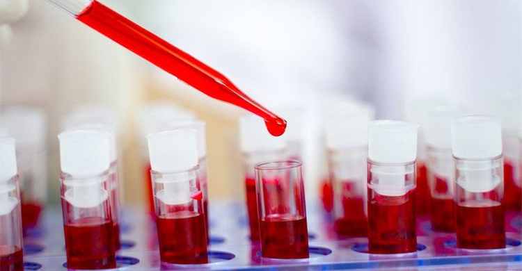 Rare case of woman's body ridding itself of HIV