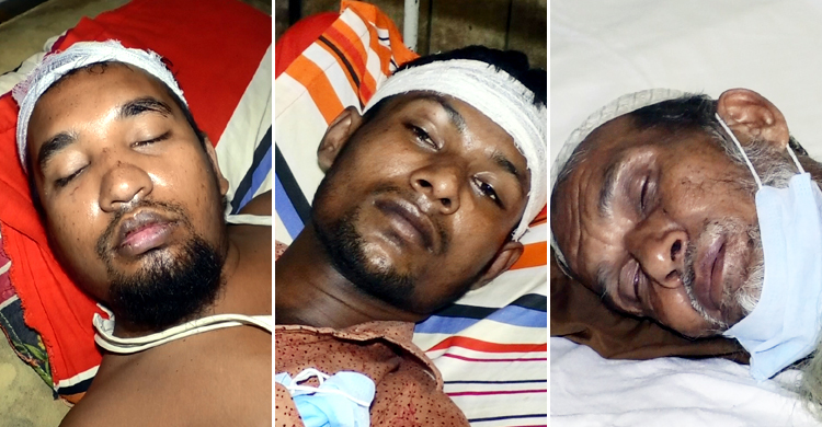 রোগী দেখতে যাওয়ায় প্রতিপক্ষের হামলায় আহত ৪
