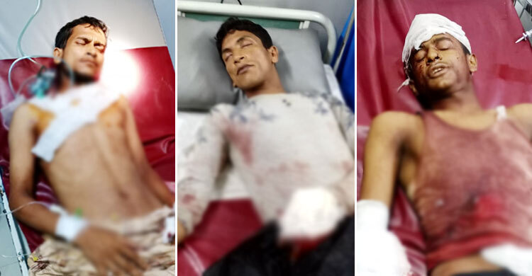 টেকনাফে রোহিঙ্গা সন্ত্রাসীদের হামলায় ৩ সহোদর গুলিবিদ্ধ